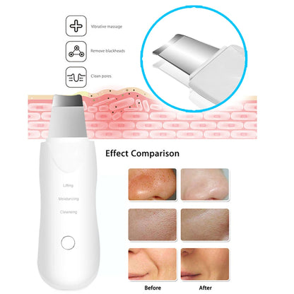 Ultrasonic Facial Skin Scrubber
جهاز تقشير وتنظيف البشرة بالموجات فوق الصوتية
