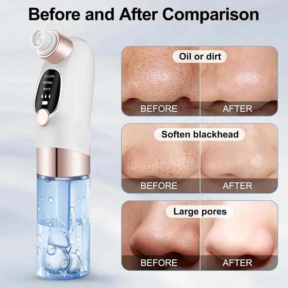 Mini Rechargeable Pore Vacuum Cleaner
جهاز شفط الرؤوس السوداء الصغير القابل لإعادة الشحن