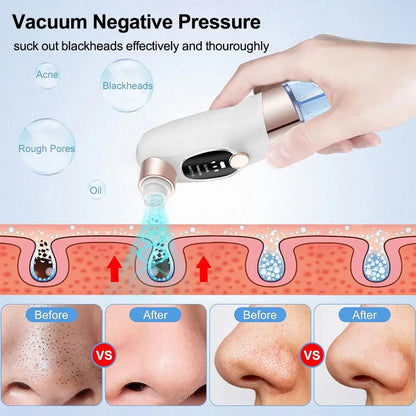Mini Rechargeable Pore Vacuum Cleaner
جهاز شفط الرؤوس السوداء الصغير القابل لإعادة الشحن