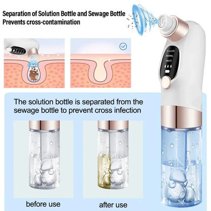 Mini Rechargeable Pore Vacuum Cleaner
جهاز شفط الرؤوس السوداء الصغير القابل لإعادة الشحن