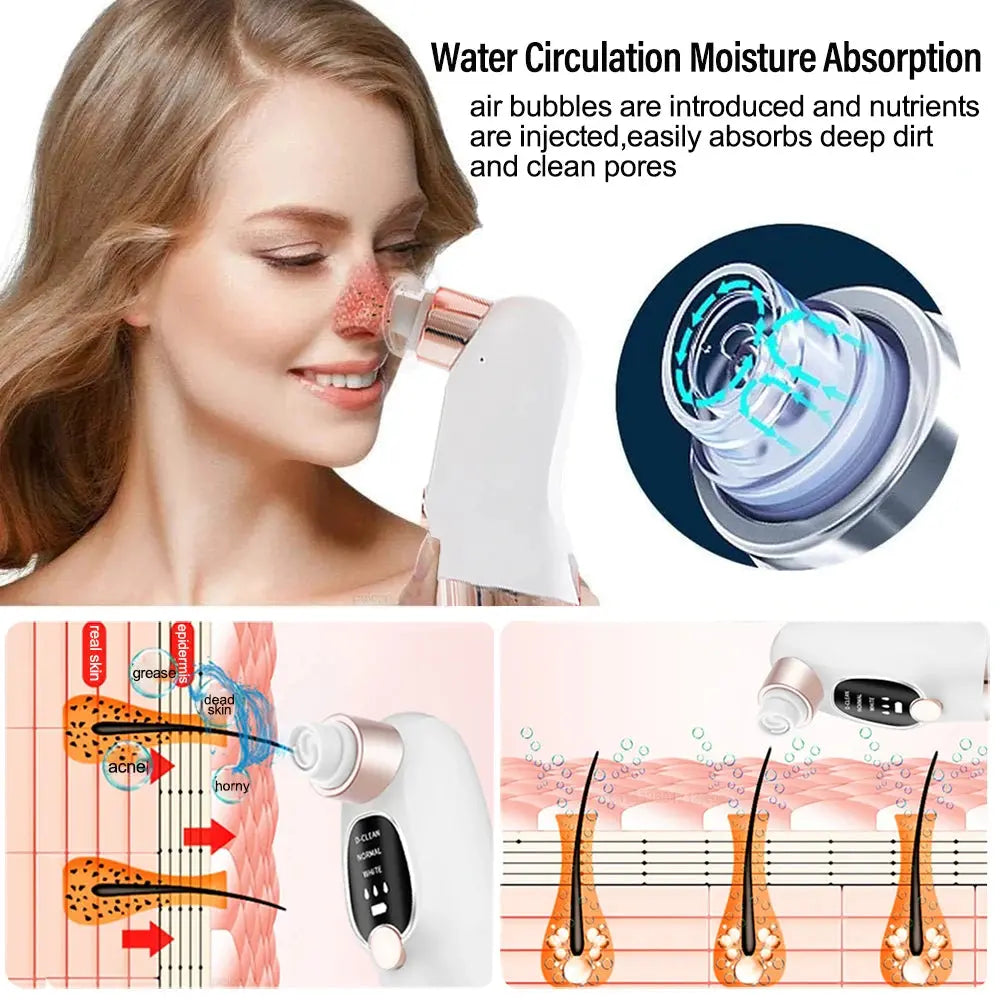 Mini Rechargeable Pore Vacuum Cleaner
جهاز شفط الرؤوس السوداء الصغير القابل لإعادة الشحن